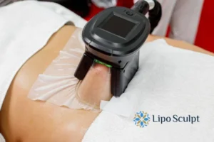 Cryolipolysis Helping You Getting that Perfect Summer Body 3 Cryolipolysis Bexleyhill can give you the best summer body - contact us today!