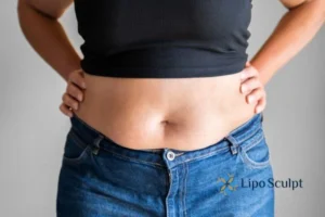 Bidding Farewell to Muffin Tops with Aqualyx Fat Injections 2 Do you wish you could reduce your muffin top Bexleyhill With Aqualy fat dissolving injections you can!