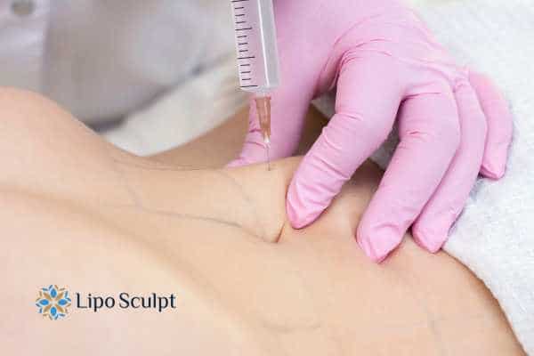 Aqualyx for Muffin Tops: What to Know Before Fat-Dissolving Injections 4 Are there risks Bexleyhill?